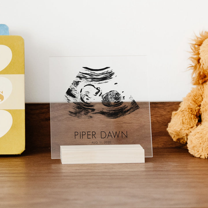 Custom Acrylic Ultrasound Art | Print Style