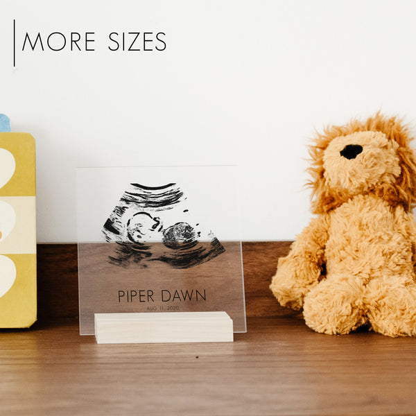 Custom Acrylic Ultrasound Art | Print Style